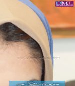 مقنعه اداری آبی تل کرم کد 13 - Image 3